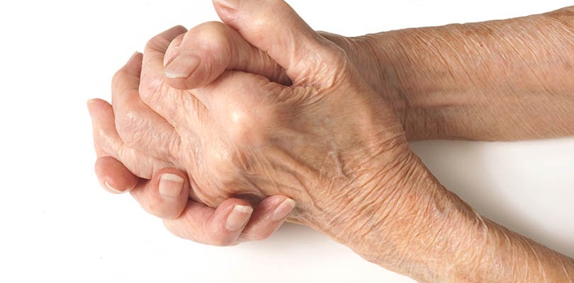 8-warning-signs-of-rheumatoid-arthritis-arthritisliving-today